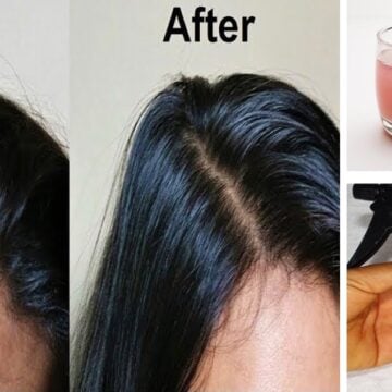 استخدام زيت البصل لتطويل الشعر وانبات الفراغات وعلاج التساقط نهائيا لن يتوقف شعرك عن النمو